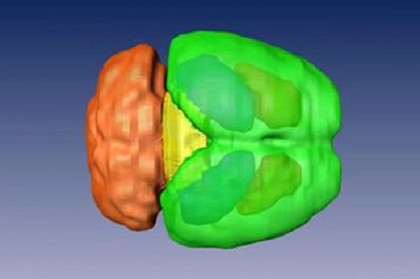 ���ݺ˴Ź�������������Խ��е�3Dģ���ؽ�