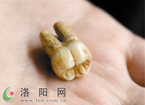 �������ݻ�ʯ