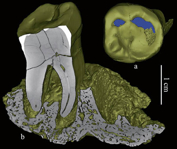 ����I�ű걾3D��ԭͼ��aҧ����ۣ�ʾ����ĥ�ĳ̶ȣ�b��״����Ƭ��ʾ�ݲ����ܲ���������ܹ�ͼ��