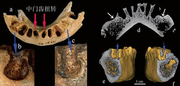 ����III�����ǲ������쳣��������ܹ�ͼ��