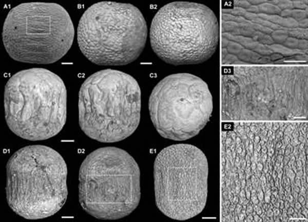 �Ͱ�����Ⱥ����������̥��ʯ�걾