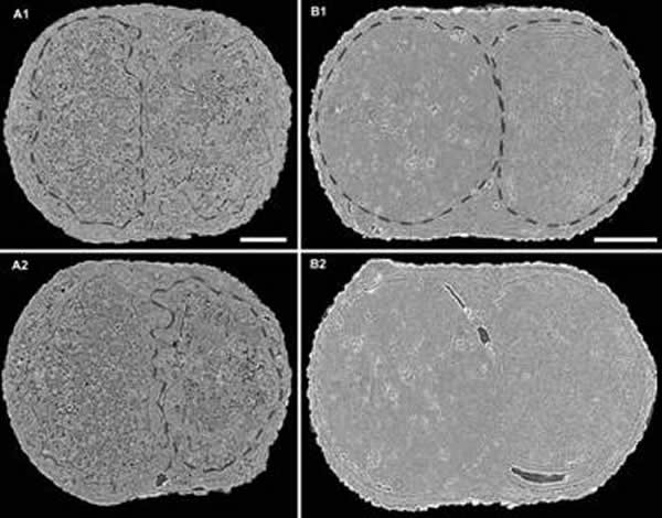 �����걾���ڲ��ṹ