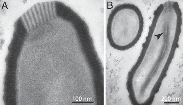 西伯利亚3万年前永冻土中发现此前未知的巨病毒