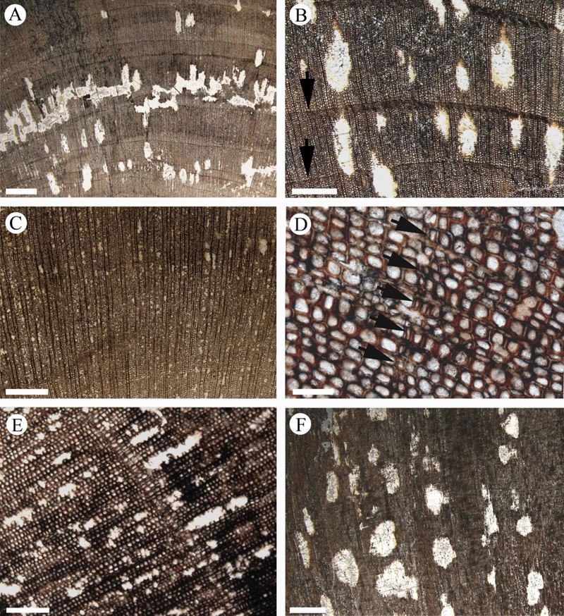 Septomedullopitys szei sp nov.次生木质部横切面