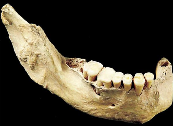 ��԰���˻�ʯ