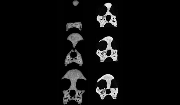 ����С��ͷ�ǵĽ�����ṹ����