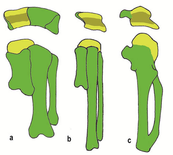 ����������ǡ��ݻ���������Ҫ�׶�