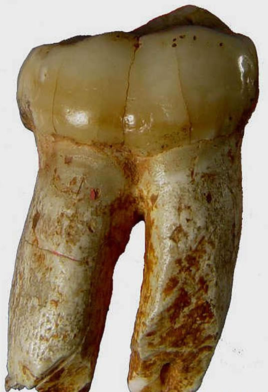 ô�ᶴ���ֵľ�Գ���ݻ�ʯ