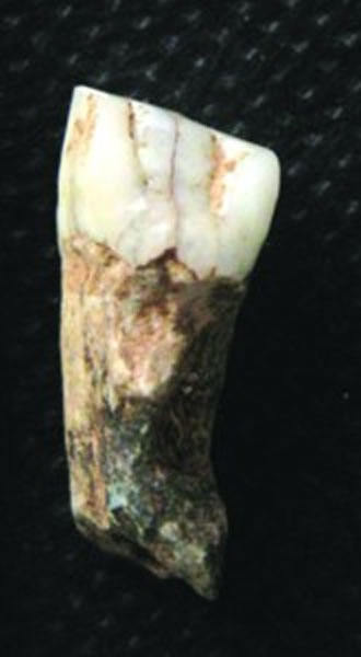 ������Ȯ�ݻ�ʯ