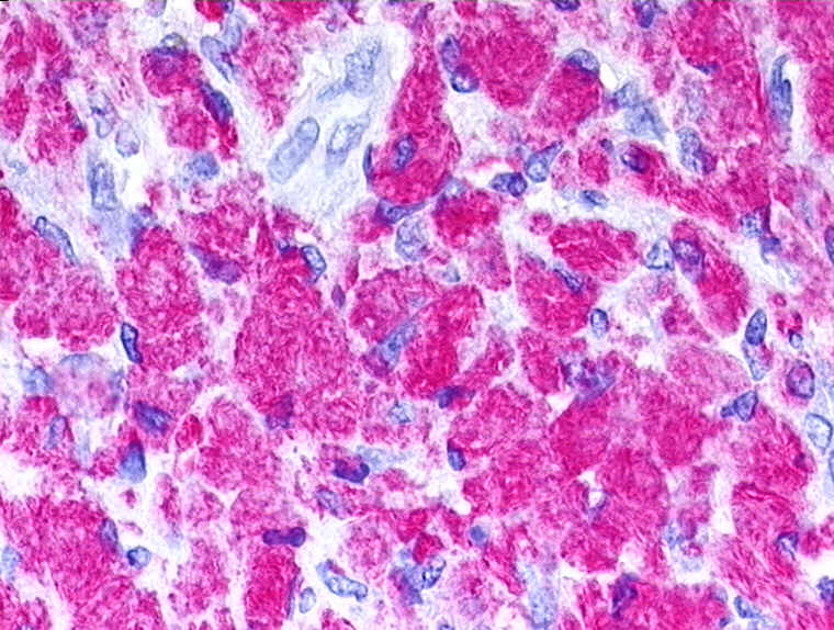 ����֦�˾���Mycobacterium leprae����������һֱ����Ϊ����粡Ψһ�Ĳ�ԭ��