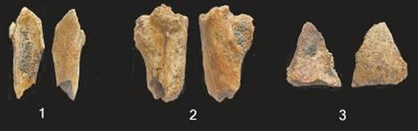 �����໯ʯ���ɹǡ�����