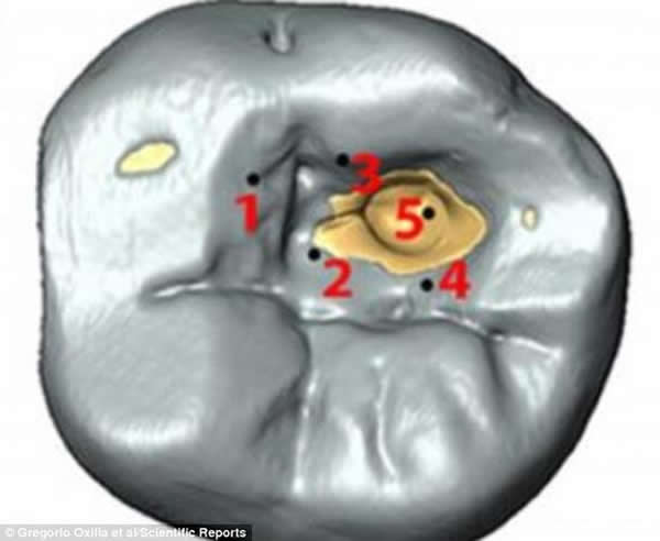 ʵ�������������ֺۼ������п��ܵĹ�����ĳ������ʯ�Ƴɵķǳ�����Ĺ��ߡ���ͼ���ڲ��۷ֲ������Ե����򣬿������Կ���ȣ�ݷ������������֯���˶�ȥ����