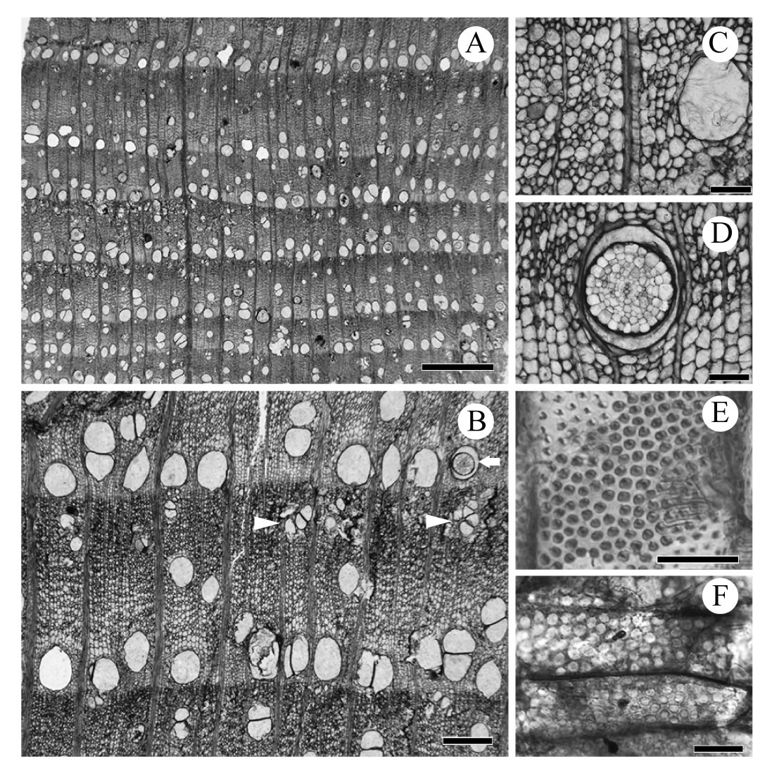 图3 Wataria木化石解剖结构