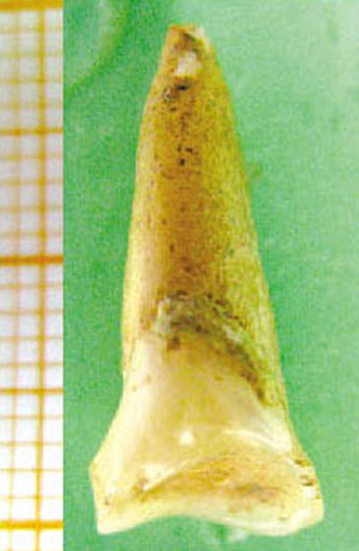 ���Ҷ������ľ�����ȫ�ִ���������������ʯ