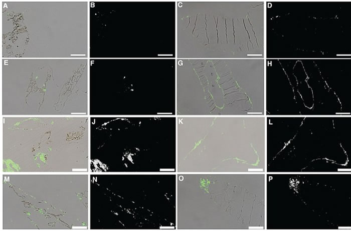 ʹ�ø߷ֱ������׷�����䷢����һ������֯