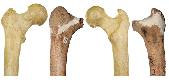 ��¹���ɹ����ִ��˹ɹǶԱ�