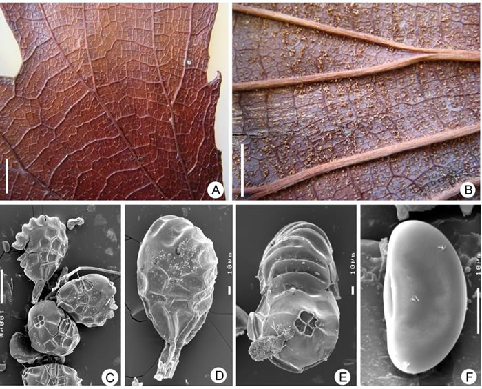 现生双扇蕨(Dipteris conjugata)的生殖叶片、孢子囊和孢子特征