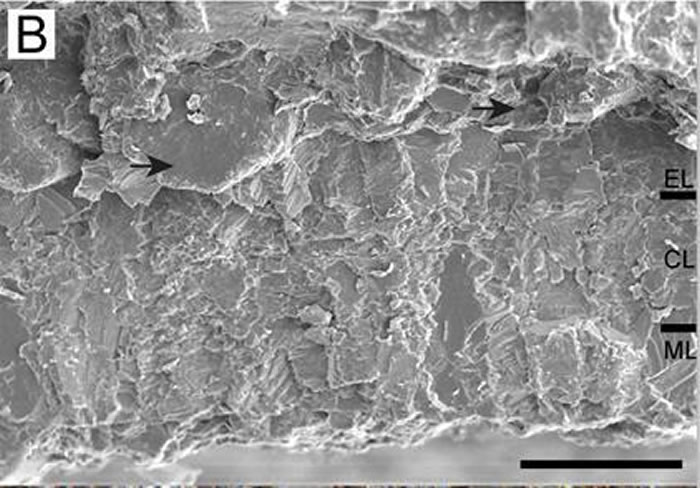 MLΪ��ͻ�㡢CLΪ�����㡢ELΪ�ⲿ��