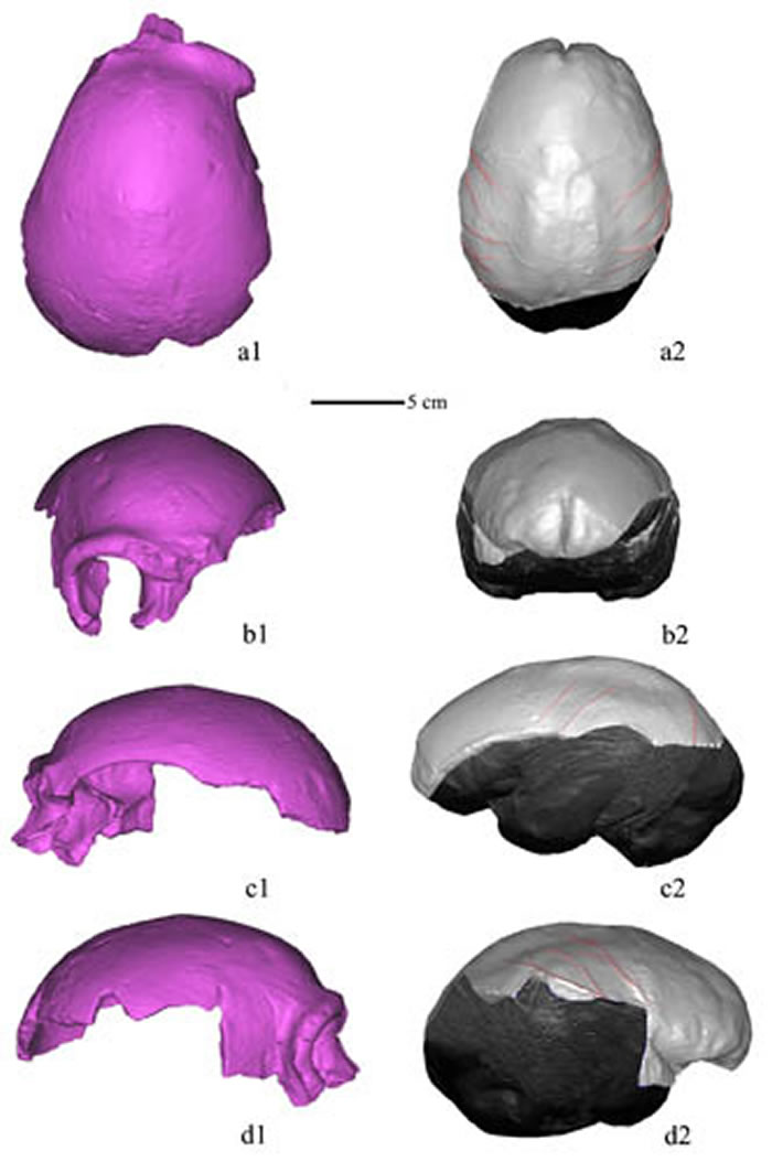 ����ͷ��CTɨ�����⸴ԭ��ͷ�ǣ�a1-d1����­��ģ��a2-d2���������(a1-a2)��ǰ���(b1-b2)��������(c1-c2)���Ҳ����(d1-d2)