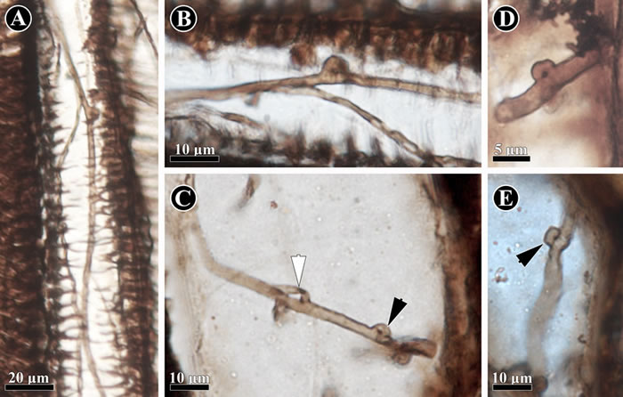 保存在科达茎干(Shanxioxylon sp.)初生木质部中的担子菌类菌丝。(黑色箭头指示锁状联合结构)