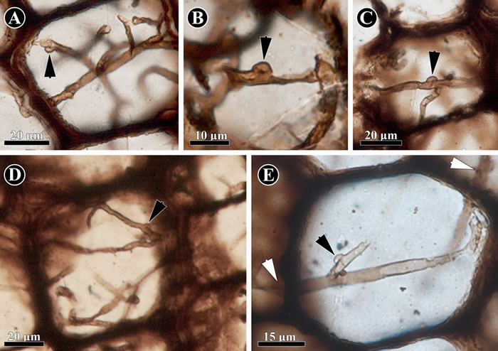 保存在科达茎干(Shanxioxylon sp.)髓部细胞中的担子菌类菌丝。(黑色箭头指示锁状联合结构)