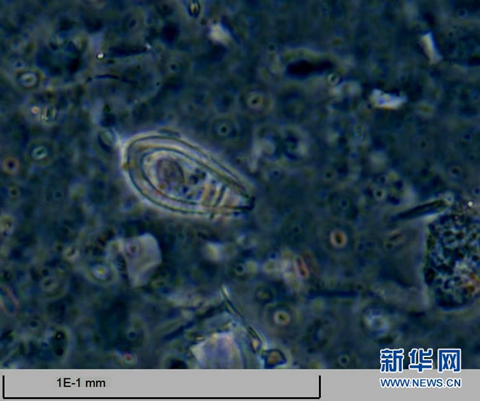 �Ž���֪���٣��׺�ɣ�Ｘ��Ǩ�����ڷŴ�1000�౶����΢���£������ġ����ϵĿ�ѧ�Ҷ����˴��Ϻ�������ȡ����о�С���΢���硱�����ԡ��»��緢������ �㣩