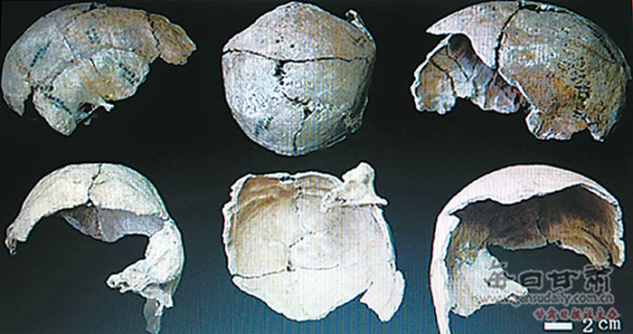 �������ˡ�ͷ�ǻ�ʯ