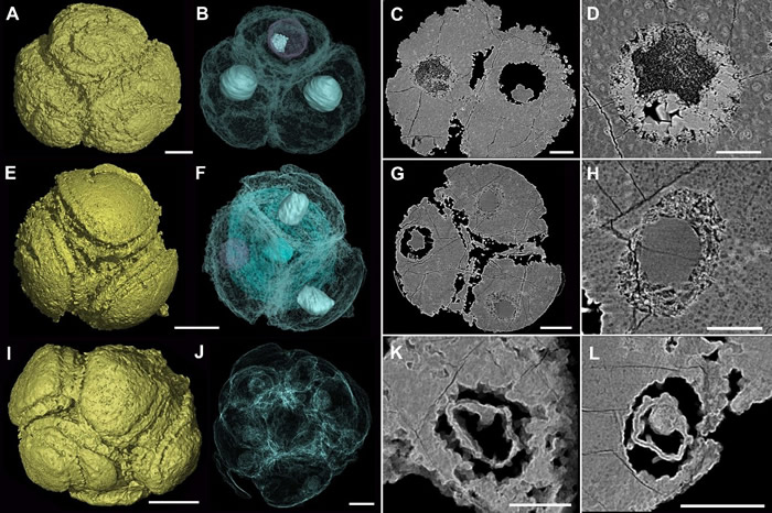 �Ͱ�����Ⱥ�����໯ʯ��ϸ���˽ṹ����ʾϸ�����ڲ�ͬ����걾�о��в�ͬ����ر���״̬��