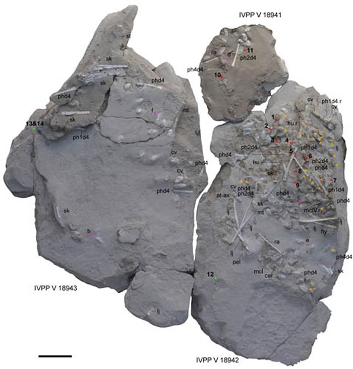 ɰбٶIVPP V 18941-18943 ɫļͷʾ̥ɫͷʾCTɨλãɫͷ