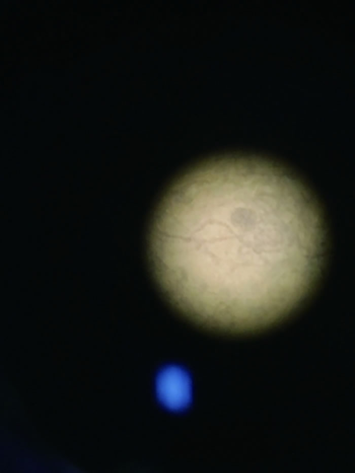 显微镜下的“大型安徽丝藻”