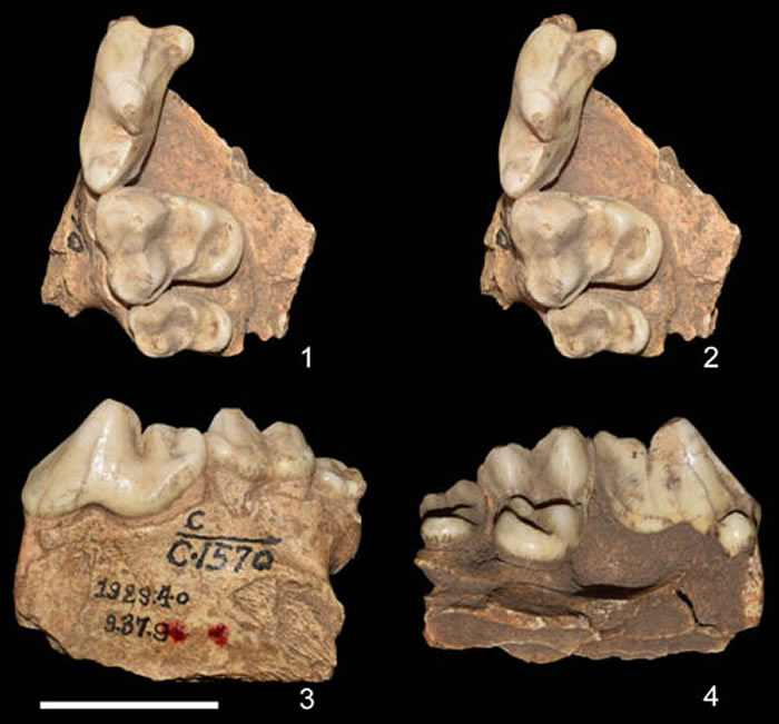 ����Ī˹�ͺ���ѡ�ͣ�������2 cm��������꽹�ͼ��