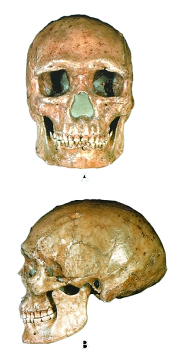 ɽ����101��ͷ��