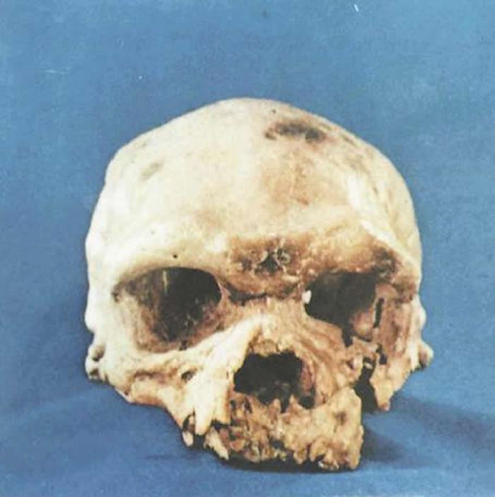 ����ʡ�����ضμҹ����Ŵ���ˮ��������������׵���ʯ���з��֡������ˡ�ͷ�ǻ�ʯ