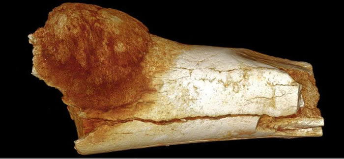 �����������Źǣ�����Odes et al.��2018��