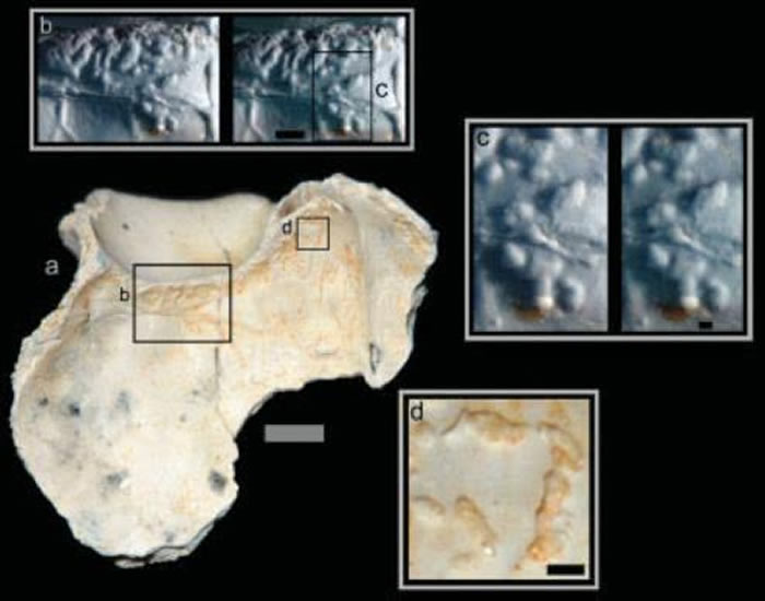 土耳其发现的具有结核病变的古人类额骨（引自Kappelman et al., 2008）