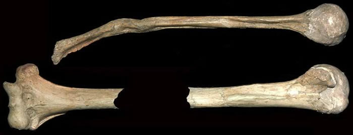伊拉克发现的残疾尼安德特人，上图为萎缩的右肱骨，下图为正常的左肱骨（引自Trinkaus and Villotte, 2017）