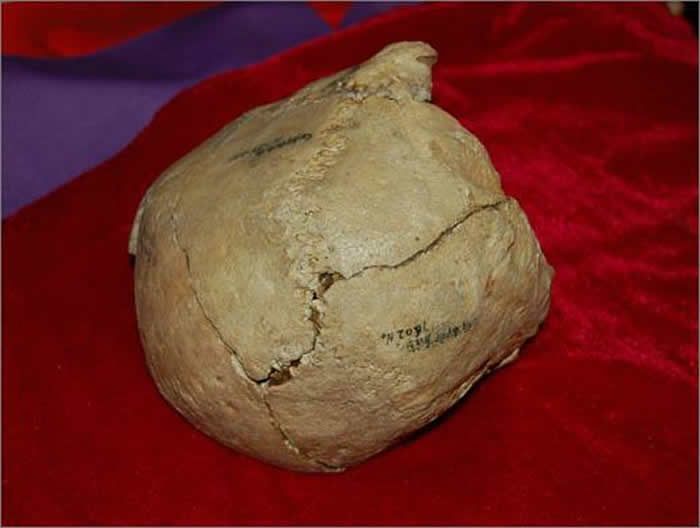 ����ʡƽ���������������硰�����ˡ�ͷ�ǹǻ�ʯ���ּ�