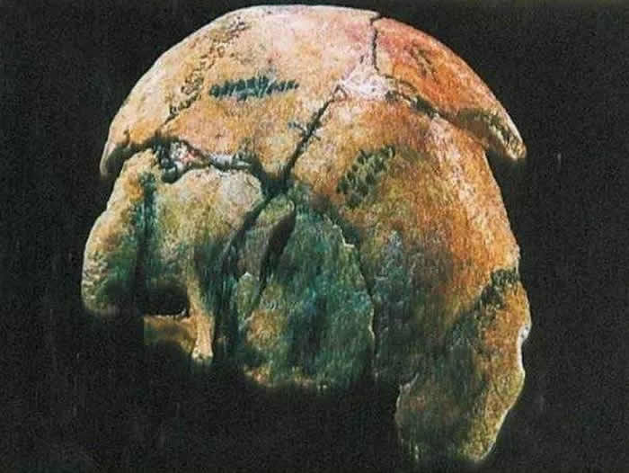 ����ʡƽ���������������硰�����ˡ�ͷ�ǹǻ�ʯ���ּ�