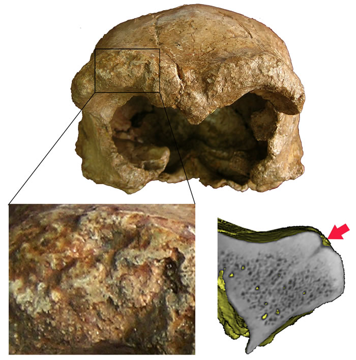 ����ֱ���˿���Բ����������ʴ�ۼ�������ܹ�ͼ��