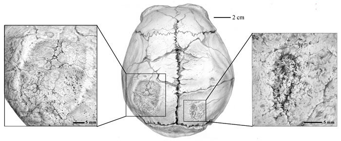 ����ֱ����ͷ�Ǻ󲿴��˺ۼ�����Ф�Ϲ�ͼ��