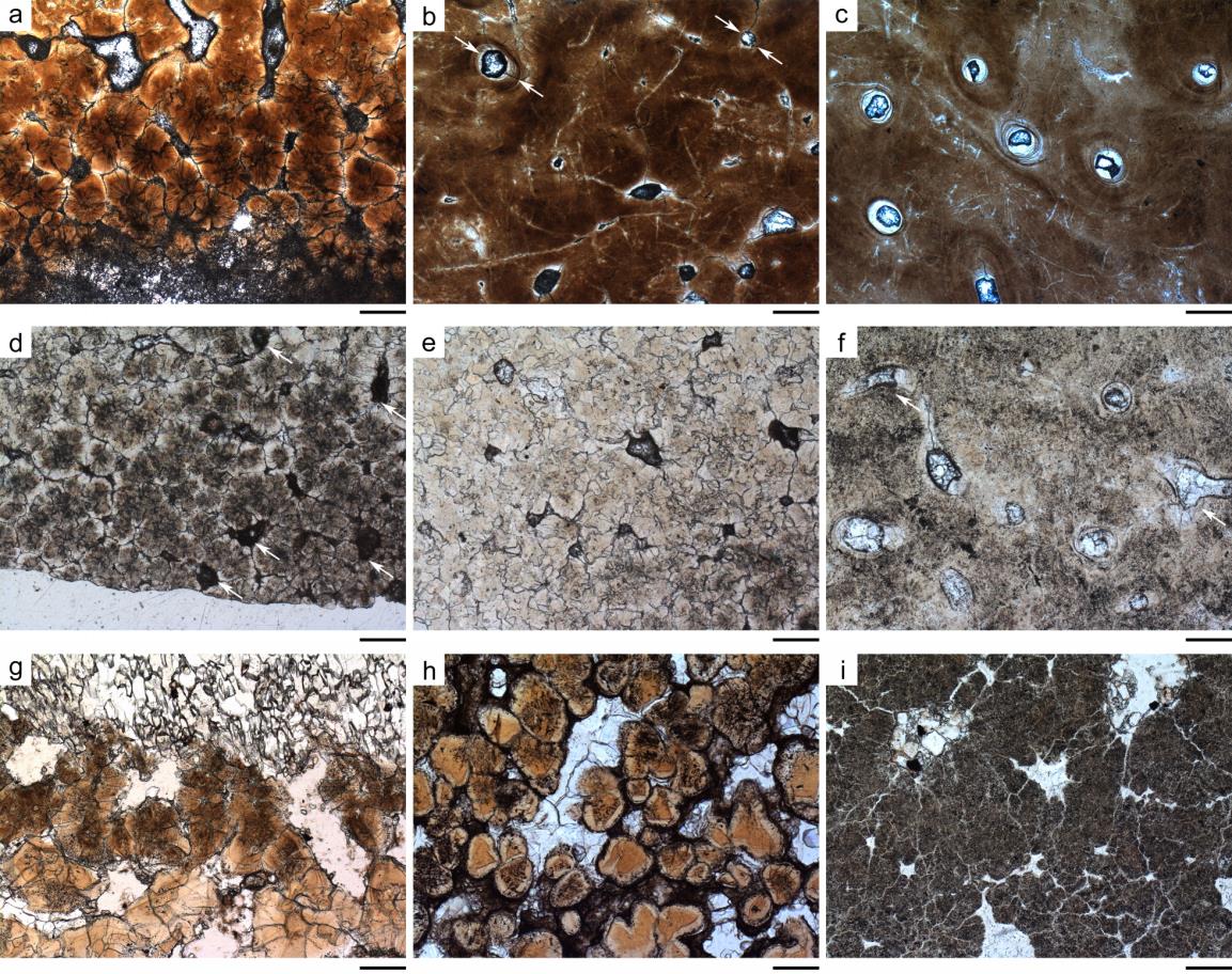 ƺ����㵰���ϡ��У��뽫����Բ�ε����£�������������΢�ṹ�Աȣ�������������Ϊ���ǽ��ڱ��棬�в����������ṹ �����Ϊ200 ��m��