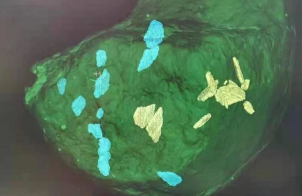 ������������ɽ��������ʯȺ���ʹ�԰�״η��ֿ���������ʯȷ��֤��