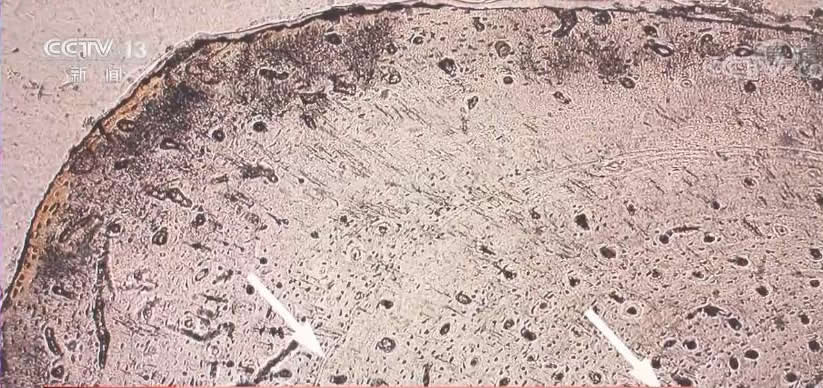 ��������Ѫ������Ѫ�������ж������䣿