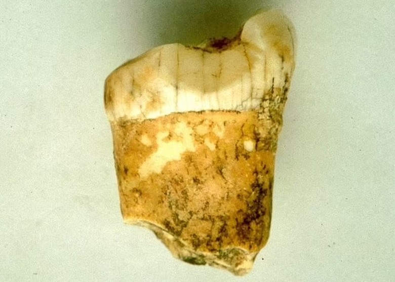 ������������������ᰲ��������Ҫʳ��ά��