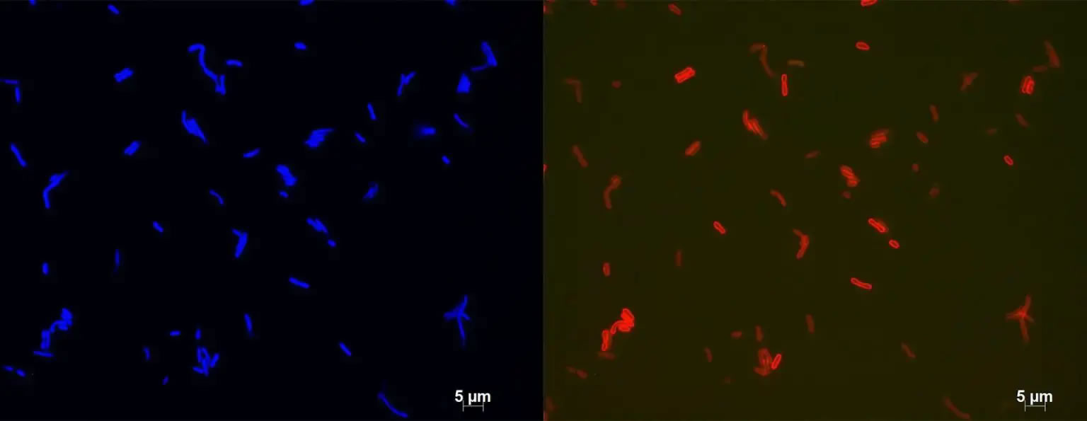 �ҿ�����仯�����ܣ�����ʯ����������ϸ����ϵ����