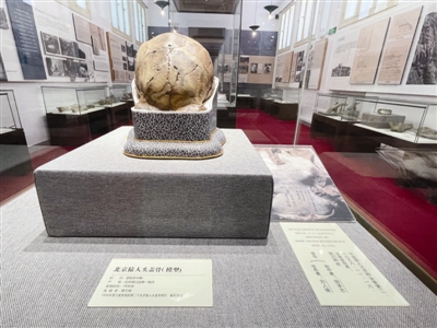 �ܿڵ���ַ�·������ඥ�ǻ�ʯ ʧ�ٵı�����ͷ�ǹ�ԭ�����縴��ģ����ر�������Ժ