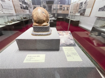 �ܿڵ���ַ�·������ඥ�ǻ�ʯ ʧ�ٵı�����ͷ�ǹ�ԭ�����縴��ģ����ر�������Ժ