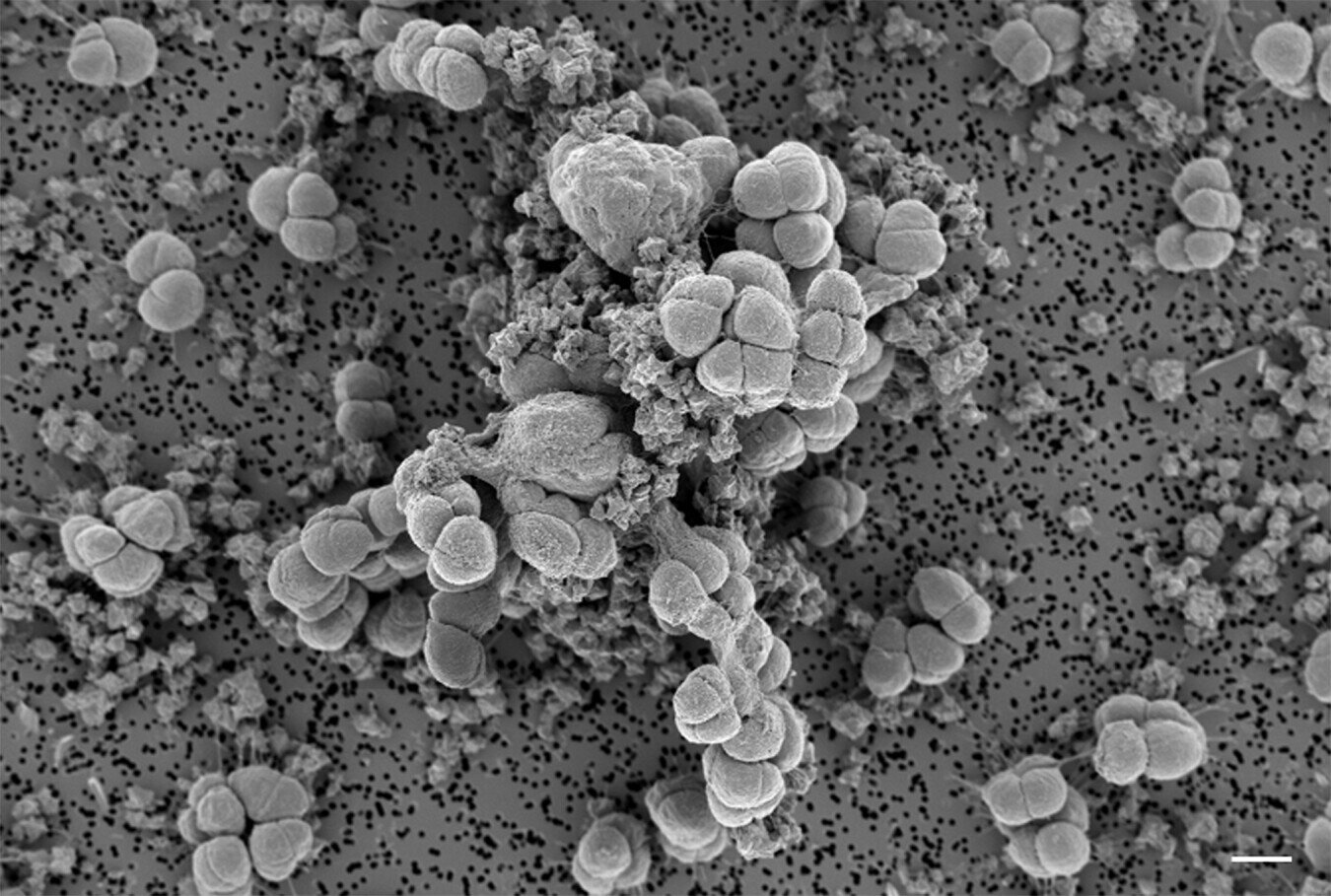 �Ŵ�΢������δӻ�������ȡ��Ҫ�Ľ���