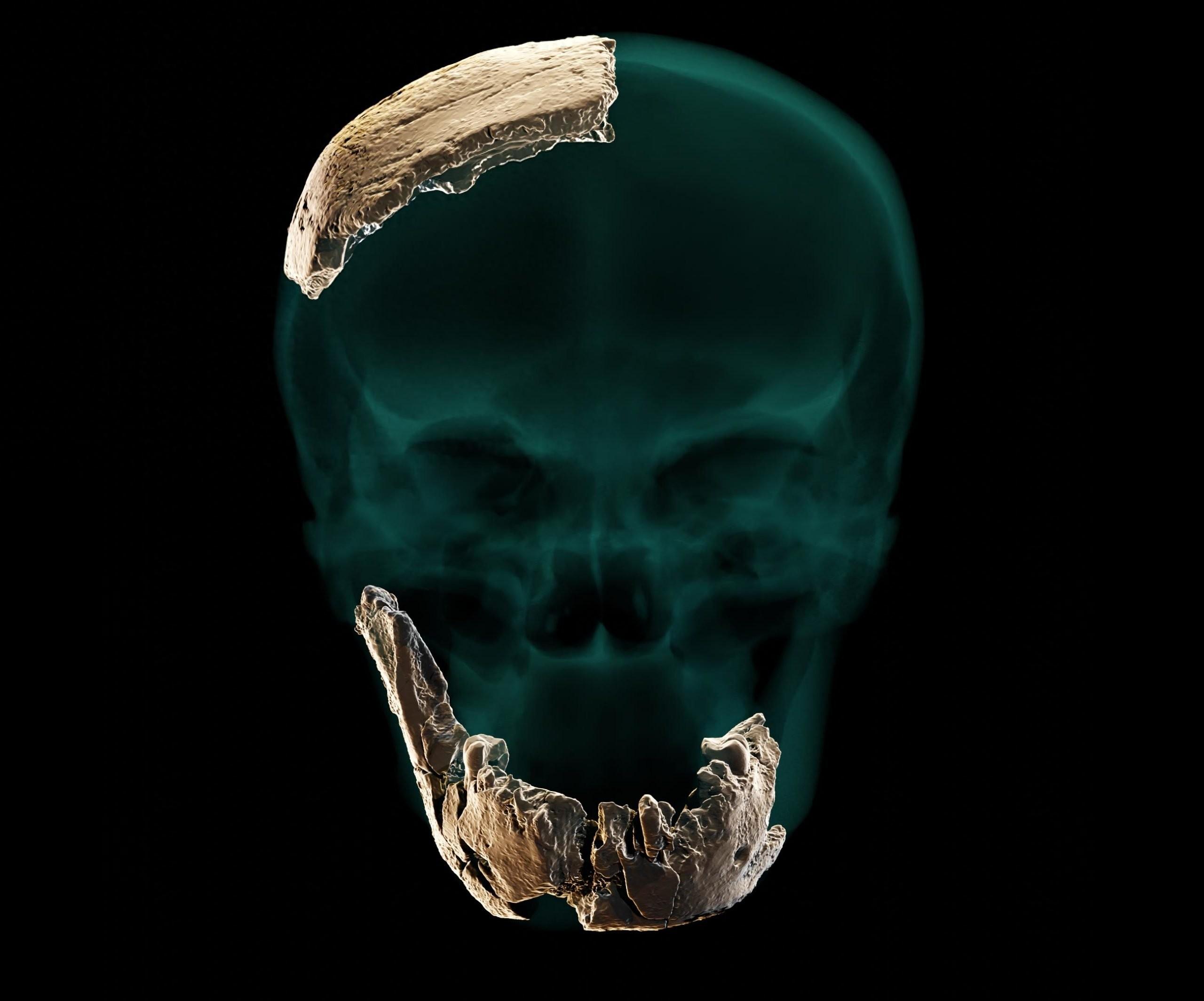 �·���Ļ�ʯ��ʾ�������跲�ص�������������Ѫͳ