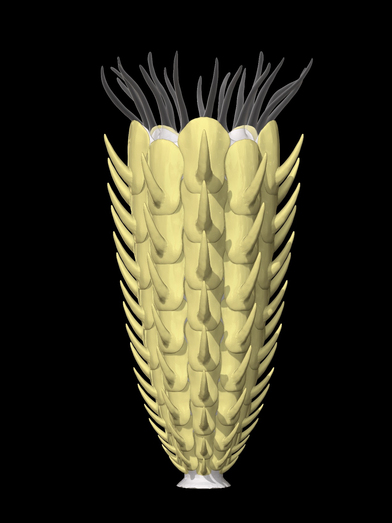 CT��ά�ؽ���ʾ������̦޺�滯ʯ���Ǻ�������ѻ�ʯ�����䶤��